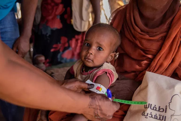 Acute food insecurity, malnutrition remain alarmingly high as crises deepen: report