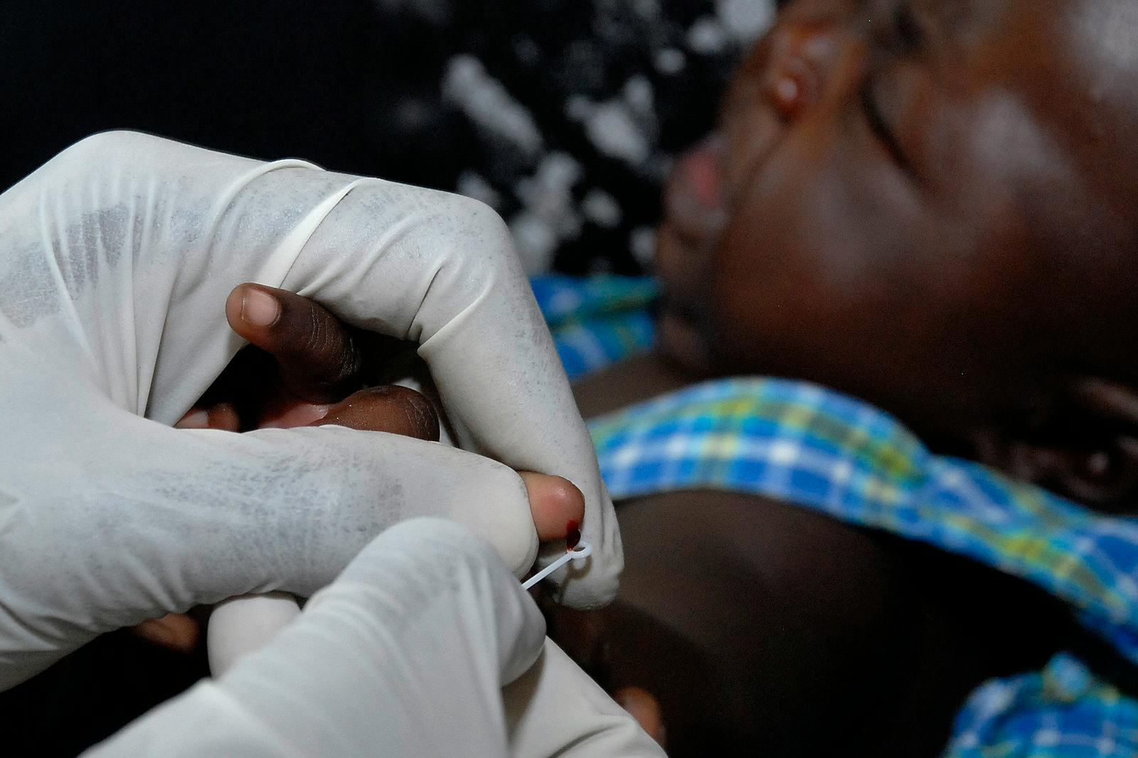 Malaria_Blood_Test_Africa