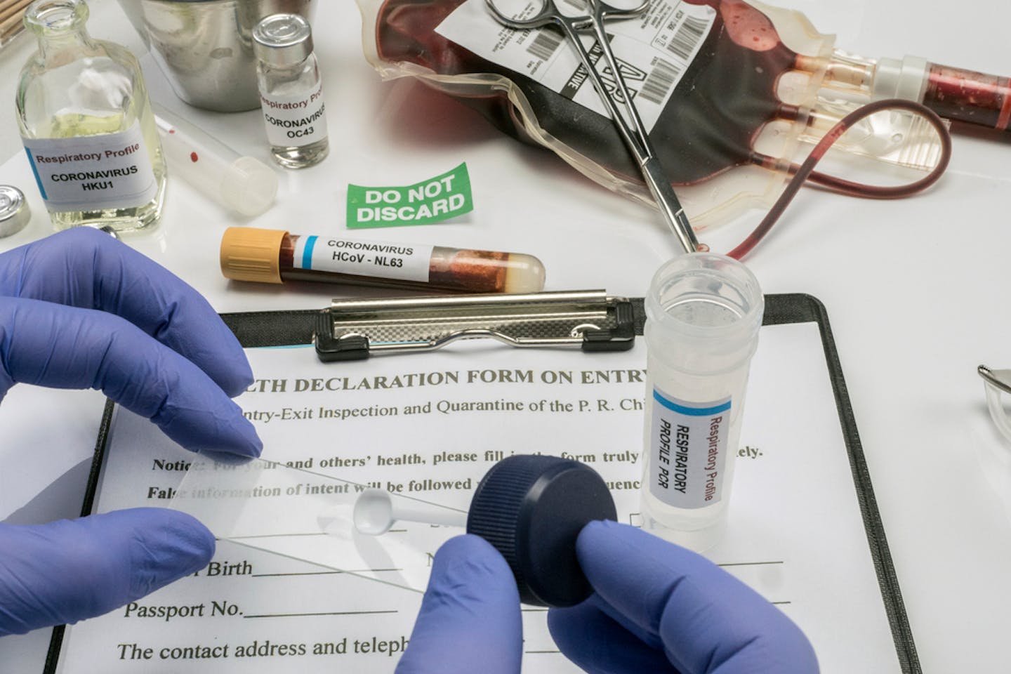sample of coronavirus